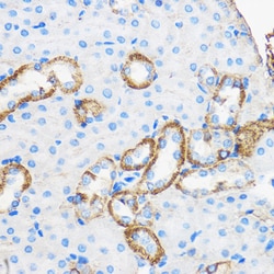 Invitrogen Apolipoprotein M Polyclonal Antibody 100 &mu;L; Unconjugated:Antibodies,