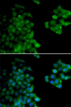 Invitrogen PSMB10 Polyclonal Antibody 100 &mu;L; Unconjugated:Antibodies,