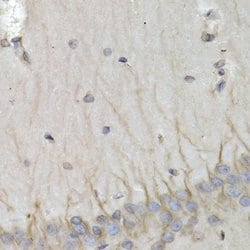 Invitrogen PSMB10 Polyclonal Antibody 100 &mu;L; Unconjugated:Antibodies,
