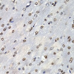 Invitrogen PSMB10 Polyclonal Antibody 100 &mu;L; Unconjugated:Antibodies,