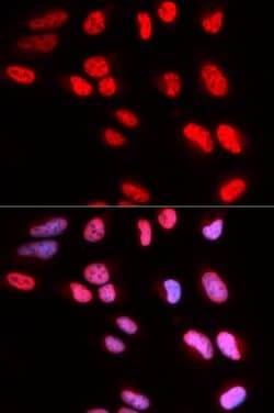 Invitrogen PRPF3 Polyclonal Antibody 100 &mu;L; Unconjugated:Antibodies,