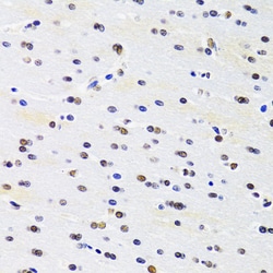 Invitrogen PRPF3 Polyclonal Antibody 100 &mu;L; Unconjugated:Antibodies,