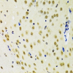 Invitrogen PRPF3 Polyclonal Antibody 100 &mu;L; Unconjugated:Antibodies,