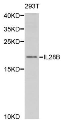 Invitrogen IL-28B Polyclonal Antibody 100 &mu;L; Unconjugated:Antibodies,