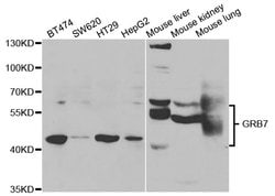 Invitrogen GRB7 Polyclonal Antibody 100 &mu;L; Unconjugated:Antibodies,