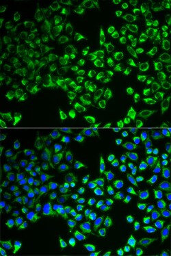 Citrate Synthase Polyclonal Antibody:Antibodies, Polyclonal