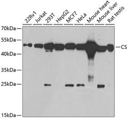 Citrate Synthase Polyclonal Antibody:Antibodies, Polyclonal