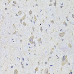 Invitrogen EEF1B2 Polyclonal Antibody 100 &mu;L | Buy Online | Invitrogen&trade; | Fisher Scientific