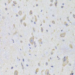 Invitrogen EEF1B2 Polyclonal Antibody 100 &mu;L | Buy Online | Invitrogen&trade; | Fisher Scientific