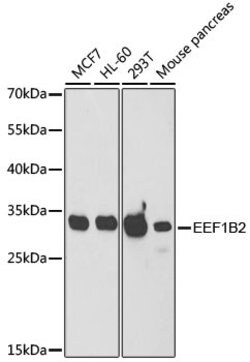 Invitrogen EEF1B2 Polyclonal Antibody 100 &mu;L | Buy Online | Invitrogen&trade; | Fisher Scientific