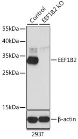 Invitrogen EEF1B2 Polyclonal Antibody 100 &mu;L | Buy Online | Invitrogen&trade; | Fisher Scientific