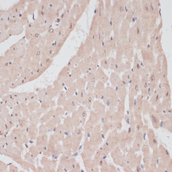 Invitrogen PRPF31 Polyclonal Antibody 100 &mu;L; Unconjugated:Antibodies,