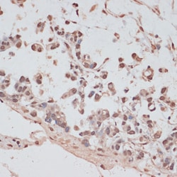 Invitrogen PRPF31 Polyclonal Antibody 100 &mu;L; Unconjugated:Antibodies,