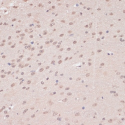 Invitrogen PRPF31 Polyclonal Antibody 100 &mu;L; Unconjugated:Antibodies,