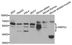 Invitrogen PRPF31 Polyclonal Antibody 100 &mu;L; Unconjugated:Antibodies,