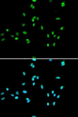 Invitrogen NR5A2 Polyclonal Antibody 100 &mu;L; Unconjugated:Antibodies,