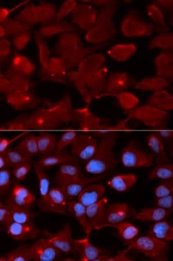 Invitrogen SMARCB1 Polyclonal Antibody 100 &mu;L; Unconjugated:Antibodies,