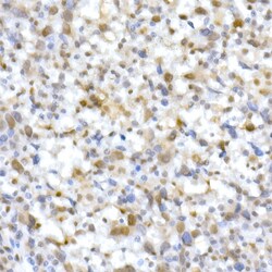 Invitrogen SMARCB1 Polyclonal Antibody 100 &mu;L; Unconjugated:Antibodies,