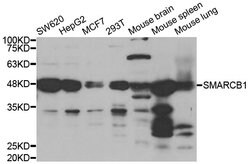 Invitrogen SMARCB1 Polyclonal Antibody 100 &mu;L; Unconjugated:Antibodies,