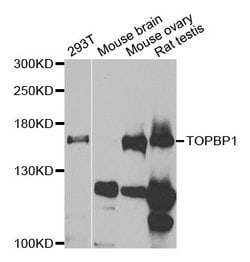 Invitrogen TOPBP1 Polyclonal Antibody 100 &mu;L; Unconjugated:Antibodies,