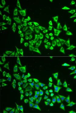 Invitrogen MRPS30 Polyclonal Antibody 100 &mu;L; Unconjugated:Antibodies,