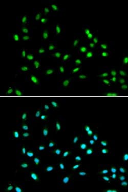 Invitrogen SMARCAD1 Polyclonal Antibody 100 &mu;L; Unconjugated:Antibodies,