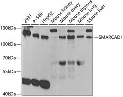 Invitrogen SMARCAD1 Polyclonal Antibody 100 &mu;L; Unconjugated:Antibodies,