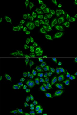 Invitrogen SRPK1 Polyclonal Antibody 100 &mu;L; Unconjugated:Antibodies,