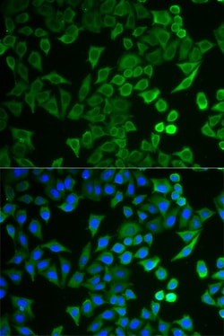 Invitrogen NPRL2 Polyclonal Antibody 100 &mu;L; Unconjugated:Antibodies,