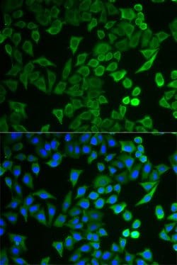 Invitrogen NPRL2 Polyclonal Antibody 100 &mu;L; Unconjugated:Antibodies,