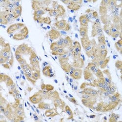 Invitrogen eIF2 gamma Polyclonal Antibody 100 &mu;L; Unconjugated:Antibodies,