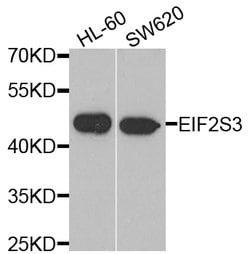 Invitrogen eIF2 gamma Polyclonal Antibody 100 &mu;L; Unconjugated:Antibodies,