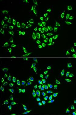Invitrogen MRPL28 Polyclonal Antibody 100 &mu;L; Unconjugated:Antibodies,