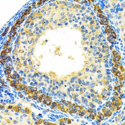 Invitrogen MRPL28 Polyclonal Antibody 100 &mu;L; Unconjugated:Antibodies,