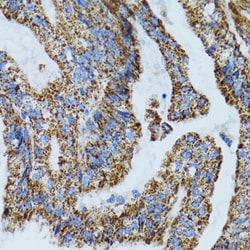 Invitrogen MRPL28 Polyclonal Antibody 100 &mu;L; Unconjugated:Antibodies,