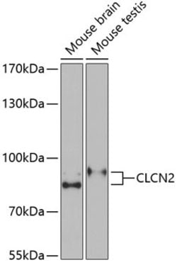Invitrogen CLCN2 Polyclonal Antibody 100 &mu;L; Unconjugated:Antibodies,