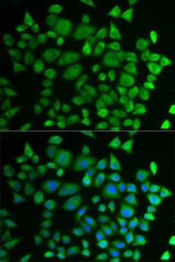 Invitrogen P4HTM Polyclonal Antibody 100 &mu;L; Unconjugated:Antibodies,
