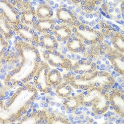Invitrogen DAP Polyclonal Antibody 100 &mu;L; Unconjugated:Antibodies,