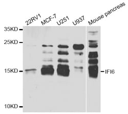 Invitrogen IFI6 Polyclonal Antibody 100 &mu;L | Buy Online | Invitrogen&trade; | Fisher Scientific