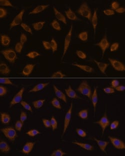 Invitrogen UGT1A1 Polyclonal Antibody 100 &mu;L; Unconjugated:Antibodies,