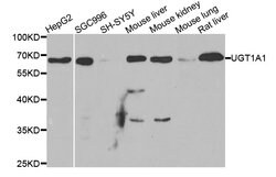 Invitrogen UGT1A1 Polyclonal Antibody 100 &mu;L; Unconjugated:Antibodies,