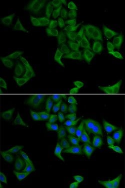 Invitrogen SMYD5 Polyclonal Antibody 100 &mu;L; Unconjugated:Antibodies,