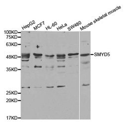Invitrogen SMYD5 Polyclonal Antibody 100 &mu;L; Unconjugated:Antibodies,