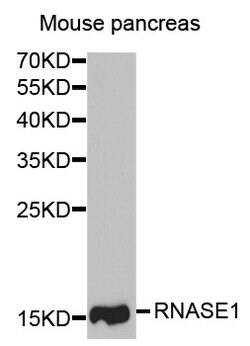 Invitrogen RNase1 Polyclonal Antibody 100 &mu;L; Unconjugated:Antibodies,