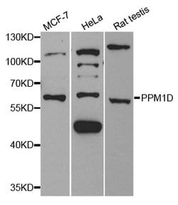 Invitrogen PPM1D Polyclonal Antibody 100 &mu;L; Unconjugated:Antibodies,