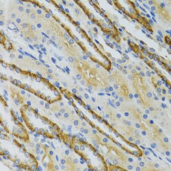 Invitrogen COG2 Polyclonal Antibody 100 &mu;L | Buy Online | Invitrogen&trade; | Fisher Scientific