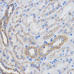 Invitrogen CYP51A1 Polyclonal Antibody 100 &mu;L; Unconjugated:Anticuerpos
