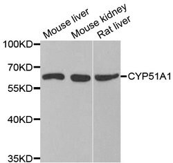 Invitrogen CYP51A1 Polyclonal Antibody 100 &mu;L; Unconjugated:Anticuerpos