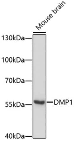 Invitrogen DMP1 Polyclonal Antibody 100 &mu;L; Unconjugated:Antibodies,