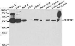 Invitrogen SERPINB1 Polyclonal Antibody 100 &mu;L; Unconjugated:Antibodies,